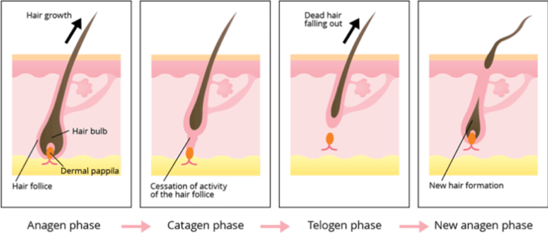Triple Wavelength Laser Hair Removal Machine Working Theory based on the principle of selective photothermodynamics. The energy of the laser wavelength can pass through the skin surface to the root of the hair follicle, and then the light in the hair follicle will be absorbed and converted into heat energy that destroys the hair follicle tissue, so that the hair in the growing period will be burned out and will die
