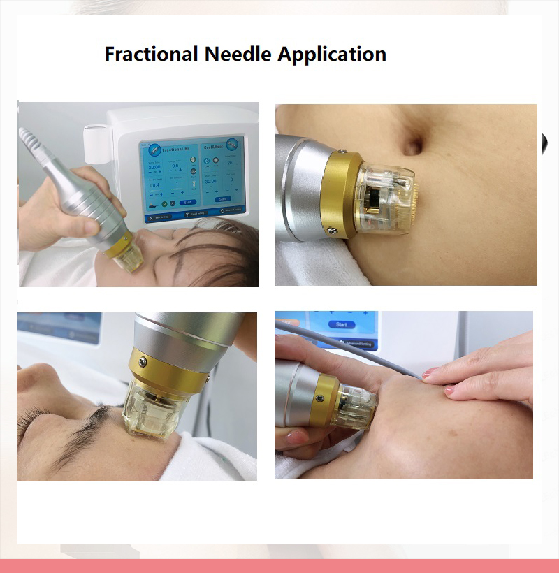 Professional skin care equipment RF micro needle machine